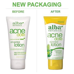 Alba Botanica Acnedote Maximum Strength Oil Control Lotion, 2 Oz